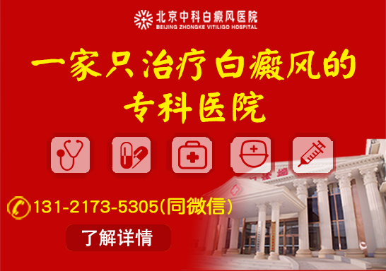 北京中科白癜风医院